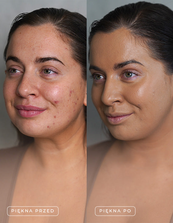 Zestaw próbek Supreme Skin